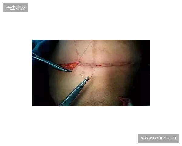 广州豹官方：杨浩眉弓伤口缝合30余针，预计5-7天后拆线